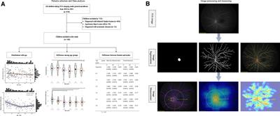 Optic disc and retinal vascular features in first 6 years of Chinese children